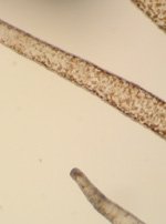 褐虫藻の共生しているイソギンチャクの写真2
