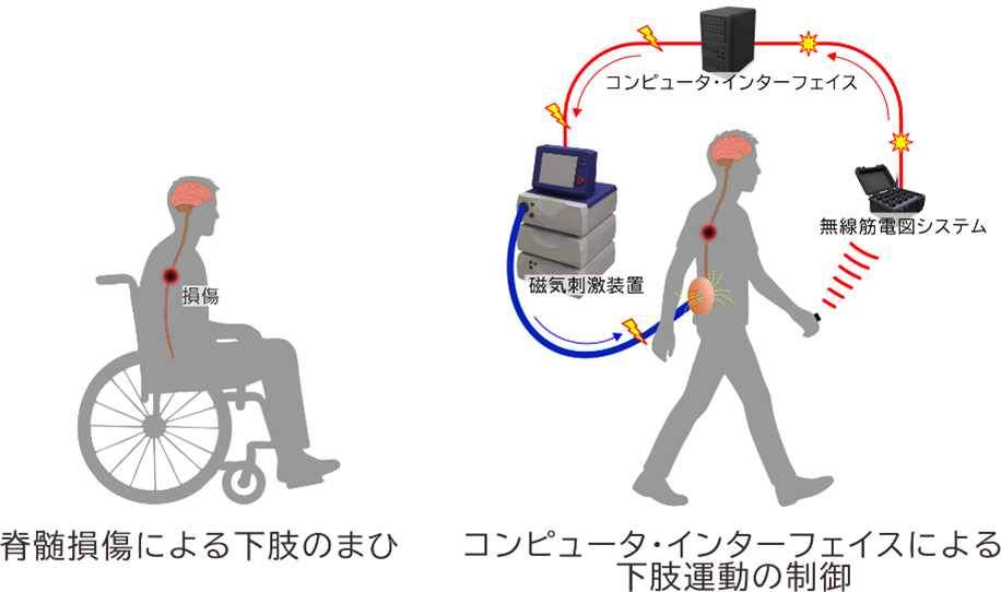 脳から脊髄へ信号をコンピュータで橋渡し 脊髄損傷者の歩行機能を回復する人工神経接続システム
