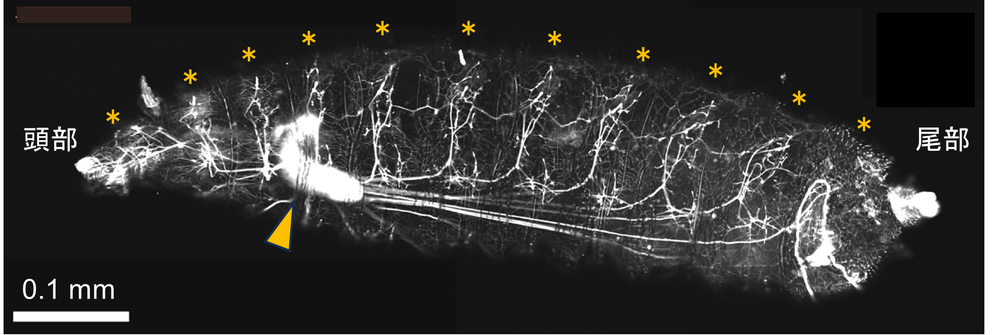 Touch and Temperature -How Special Fats Fine-Tune Our Senses-