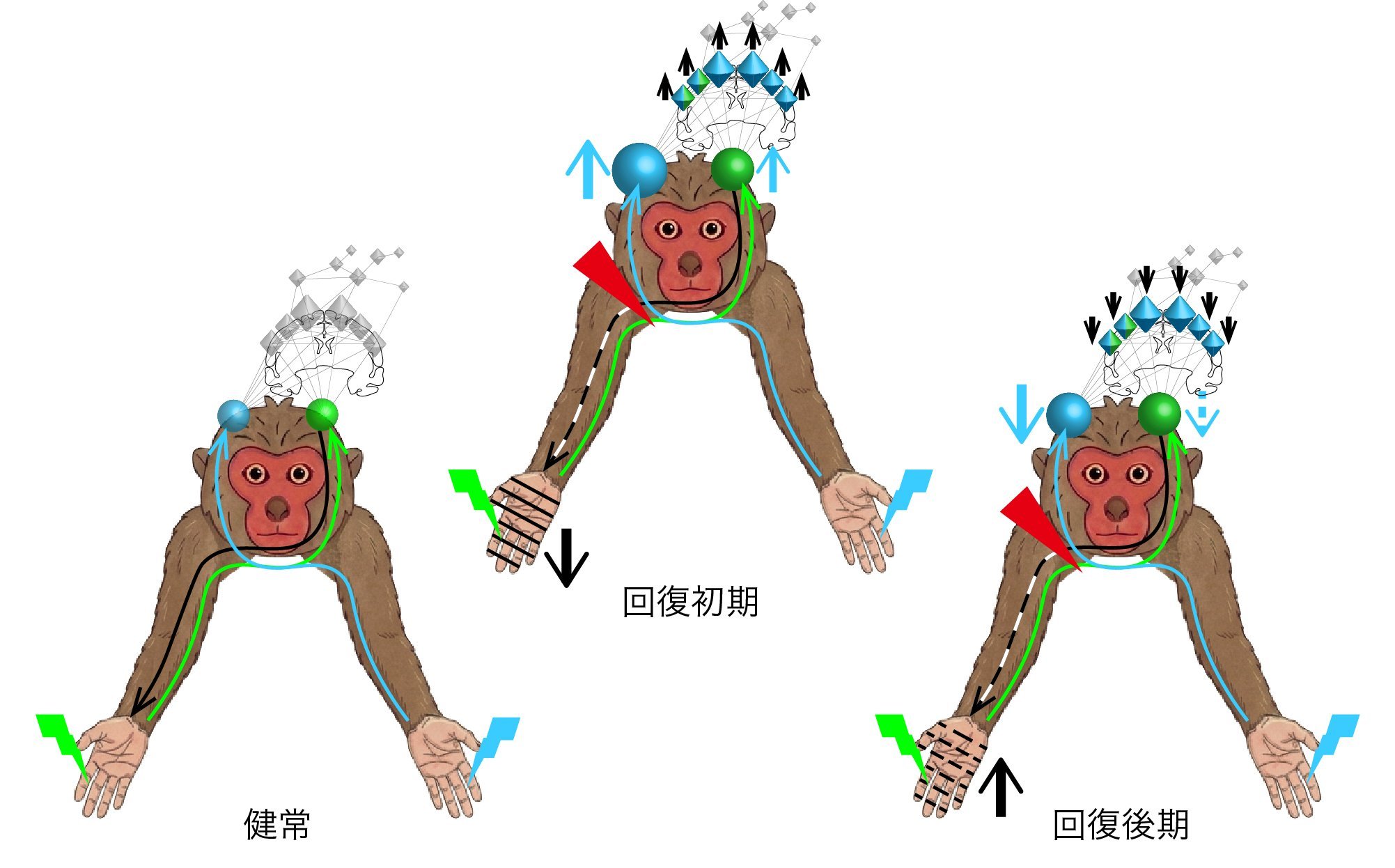 非麻痺手への刺激が明らかにした脊髄損傷後の脳の再構築--手の運動回復との関連を発見