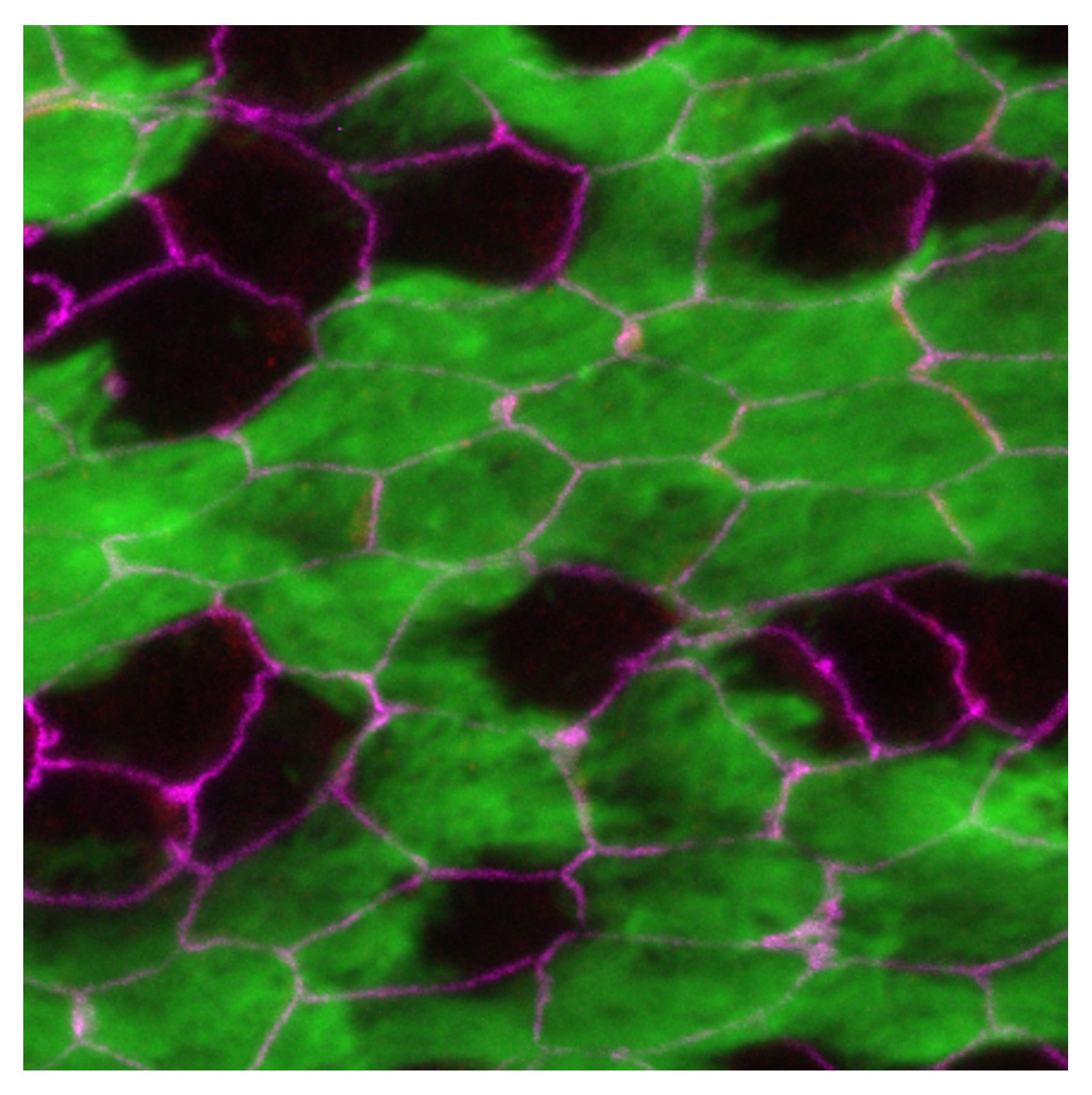 不均一な組織で細胞の向きを揃えるメカニズム ～数理とAIが明らかにした細胞種配置のルール～