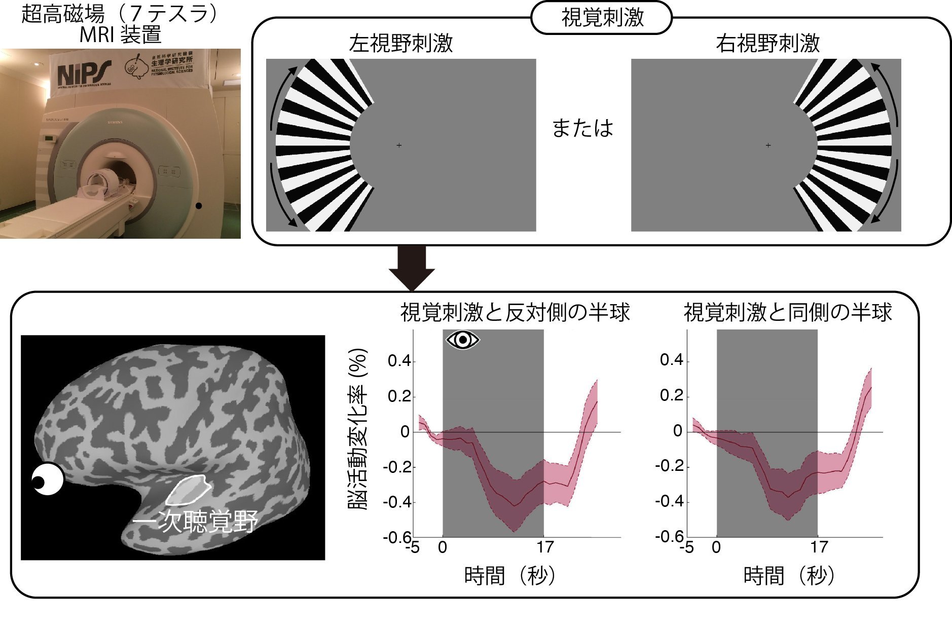 視覚は、どのように聴覚野を抑制するのか？ ～超高磁場fMRIが解き明かす感覚間抑制のメカニズム～